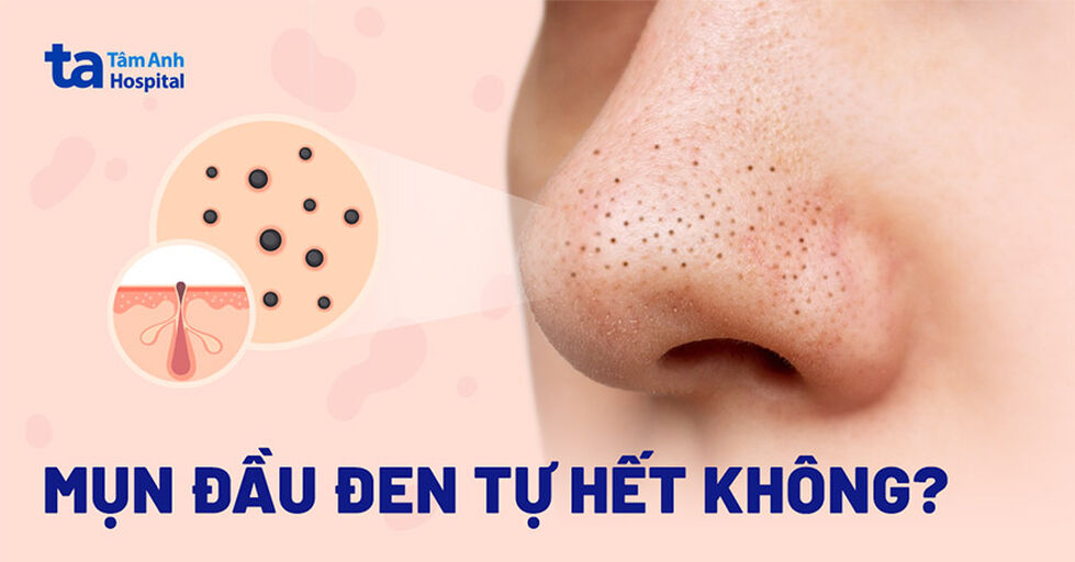 @cachtrimundauden Profile Picture