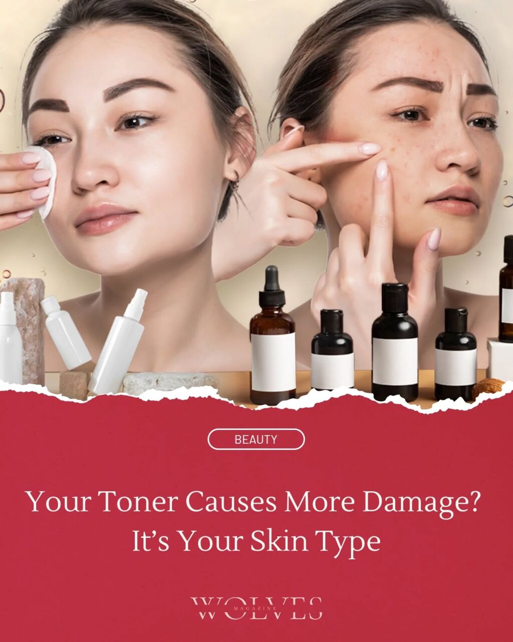 Your Toner Causes More Damage? It&rsquo;s Your Skin Type