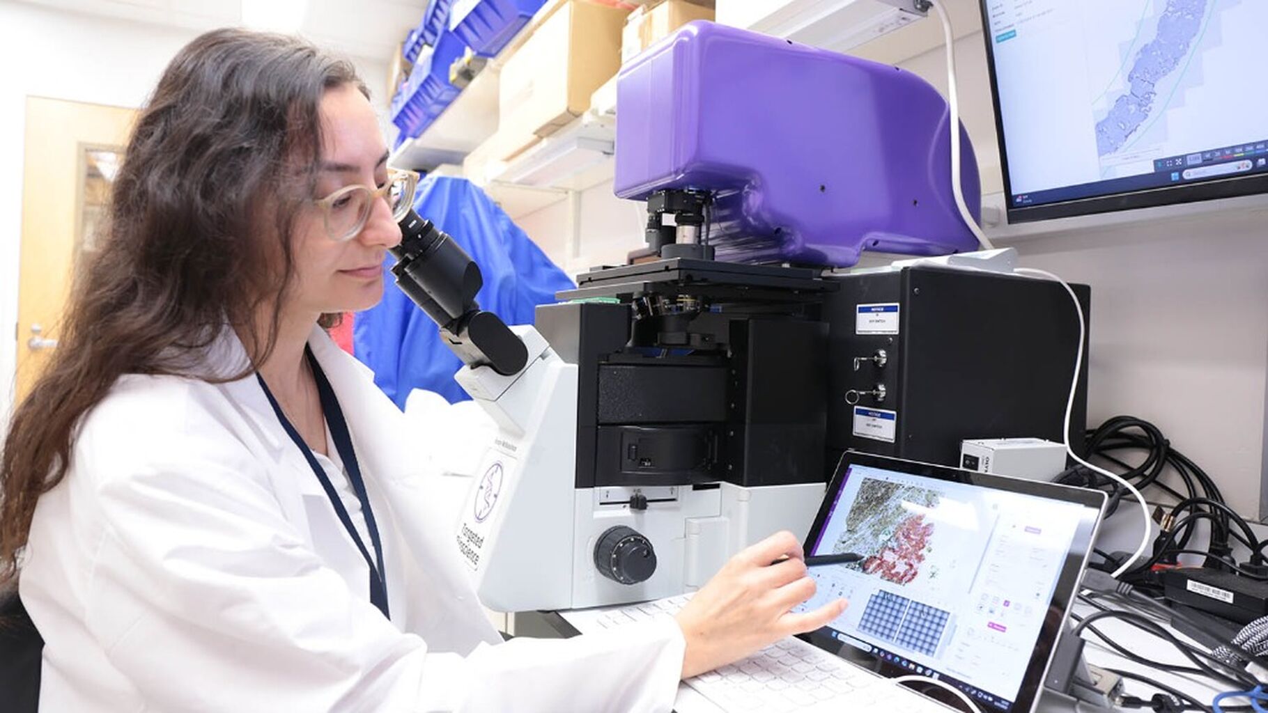 A Crystal Ball for Prostate Cancer Treatment