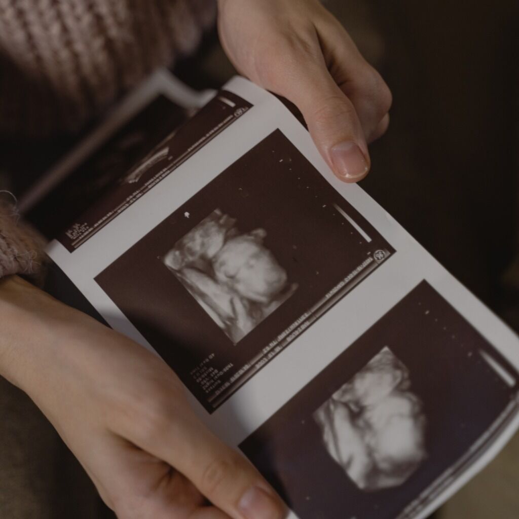 Schedule Your Free Ultrasound