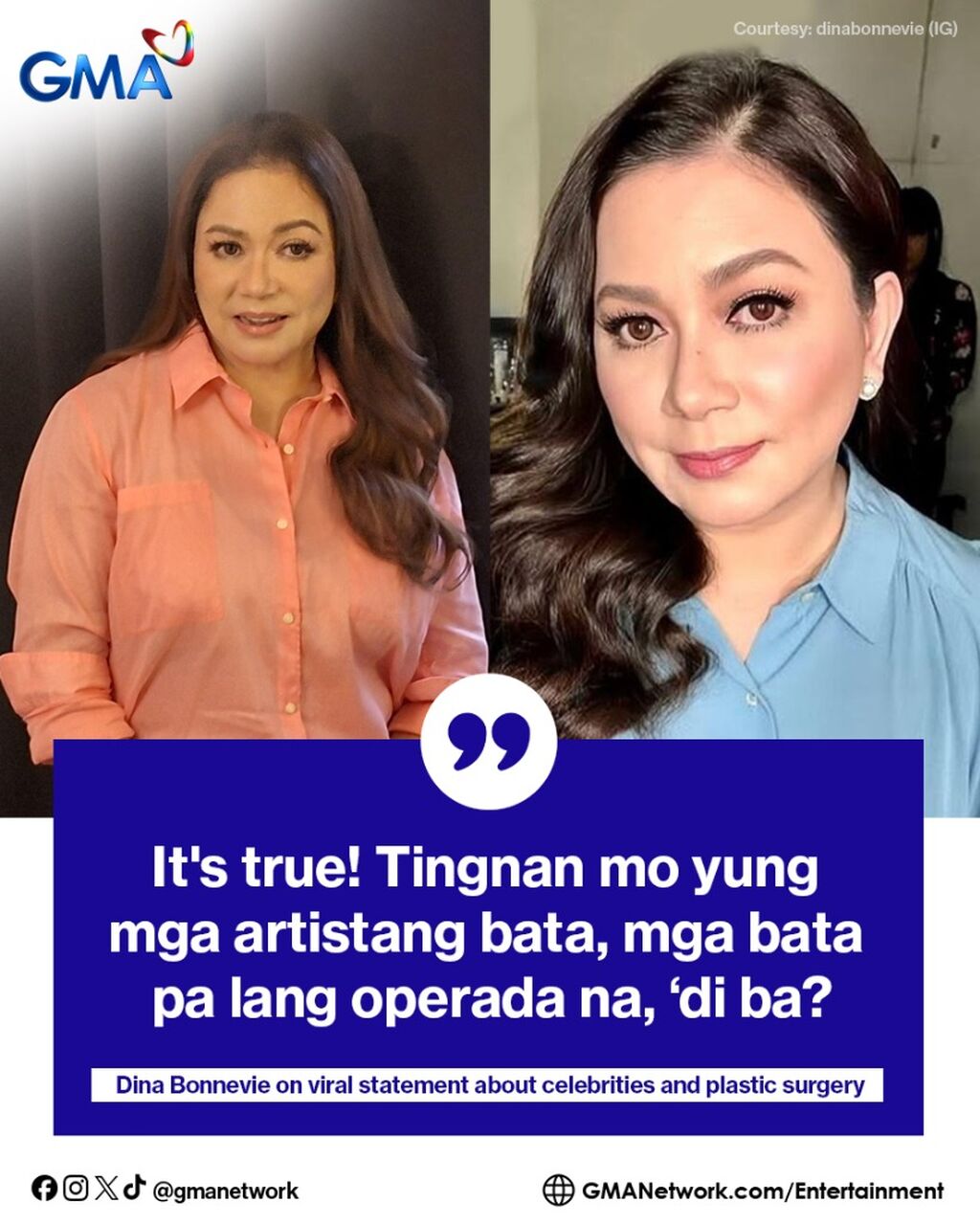 Dina Bonnevie on viral statement about celebrities and plastic surgery: 'It's true'