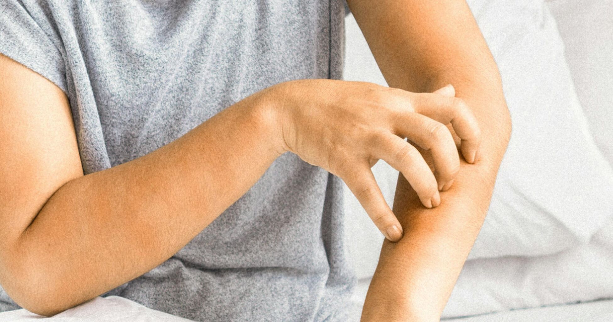 How to Stop Itchy Perimenopause Skin