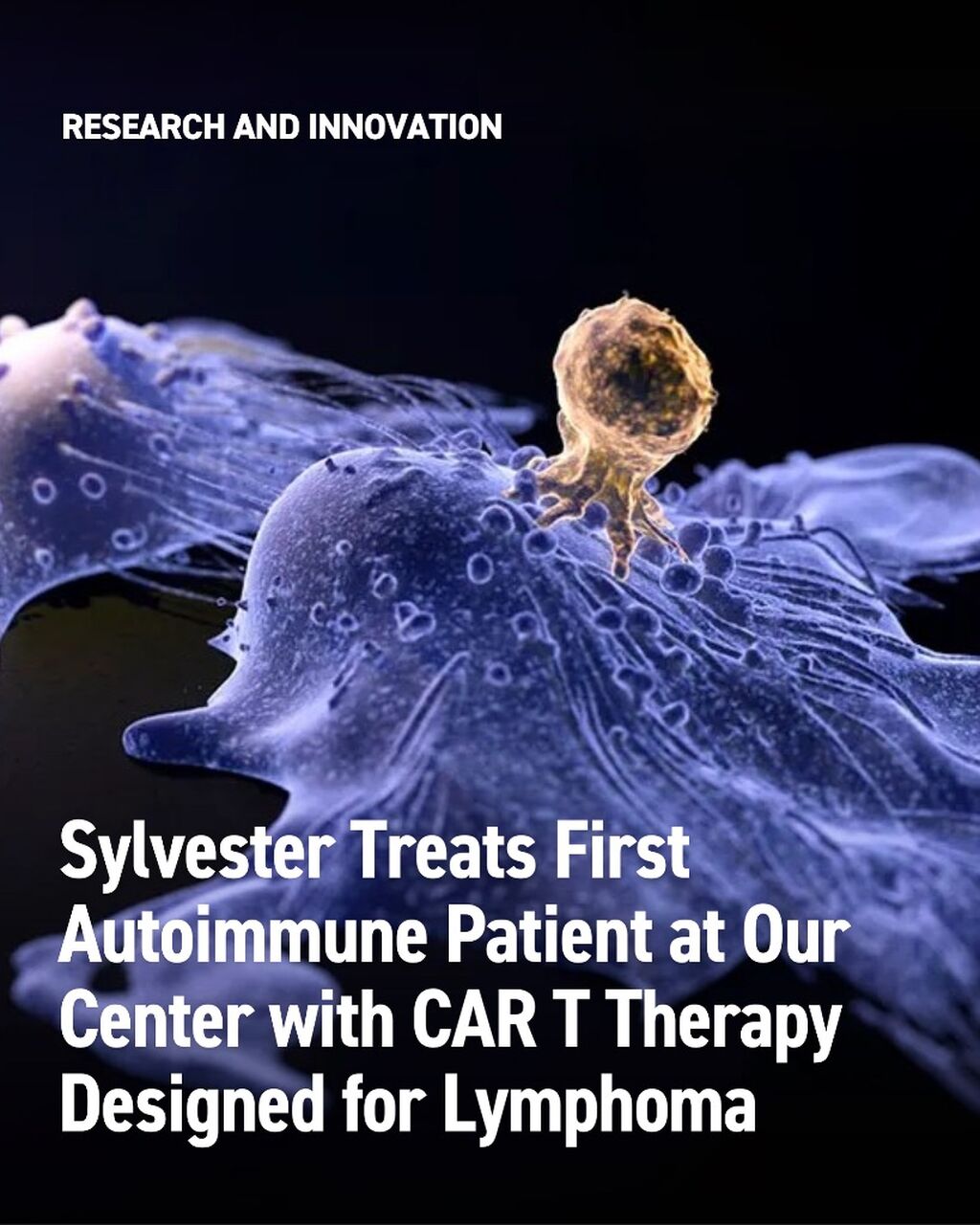 Cellular&nbsp;Therapy&nbsp;Developed for&nbsp;Cancer&nbsp;Now&nbsp;Being&nbsp;Tested in&nbsp;Autoimmune&nbsp;Disease - InventUM