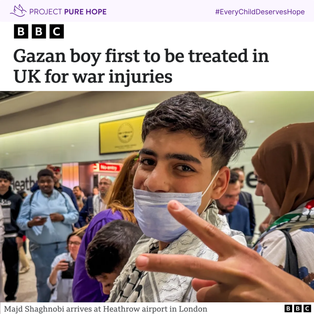 article: Gazan boy first to be treated in UK for war injuries