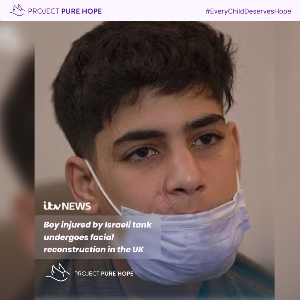 Boy injured by Israeli tank undergoes facial reconstruction in the UK 
