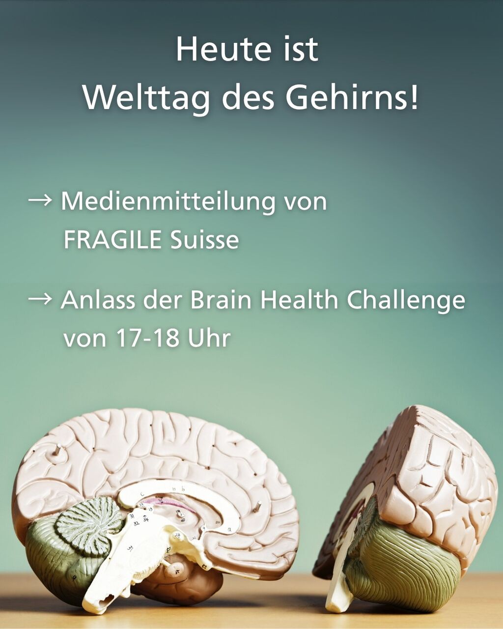 Welttag des Gehirns Medienmitteilung