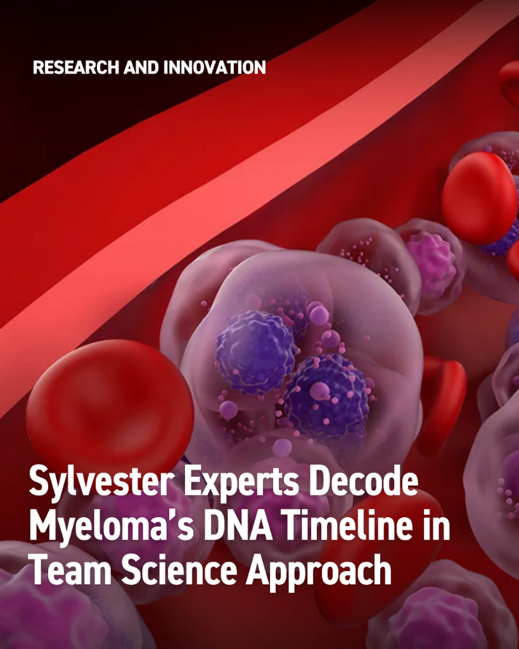 Multiple Myeloma&rsquo;s Timeline Revealed - InventUM