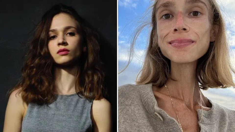Muere joven por desnutrici&oacute;n al adoptar dieta exclusiva de frutas
