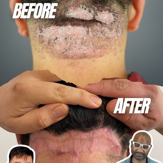 10 years of AKN - 1 Final Result