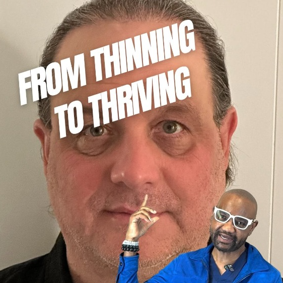 From Thinning to Thriving