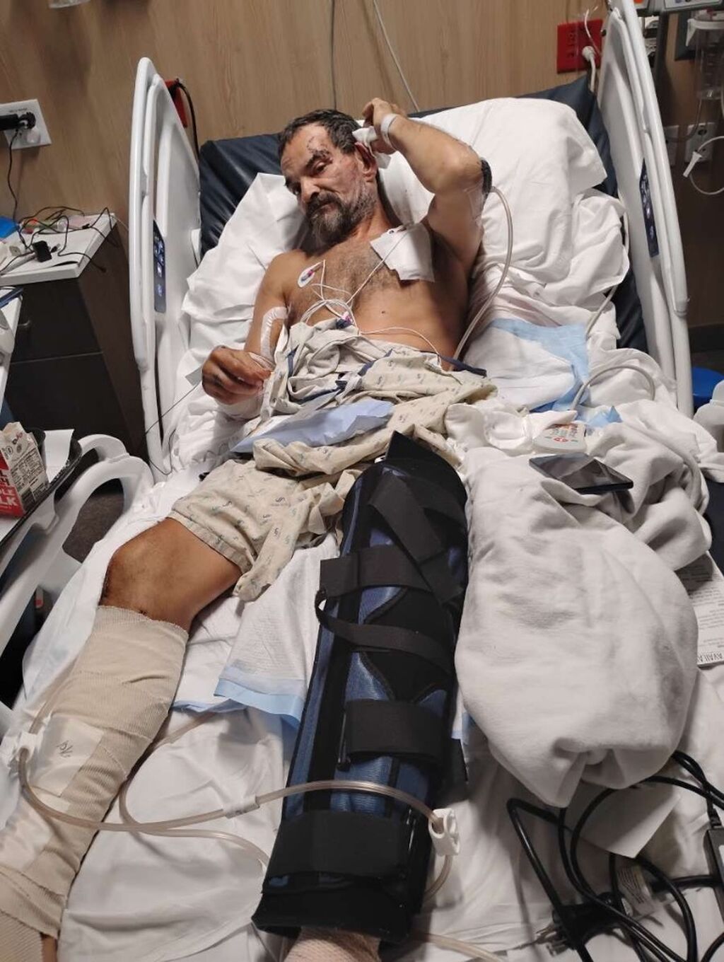 Help Edward Gordon, man hit by car