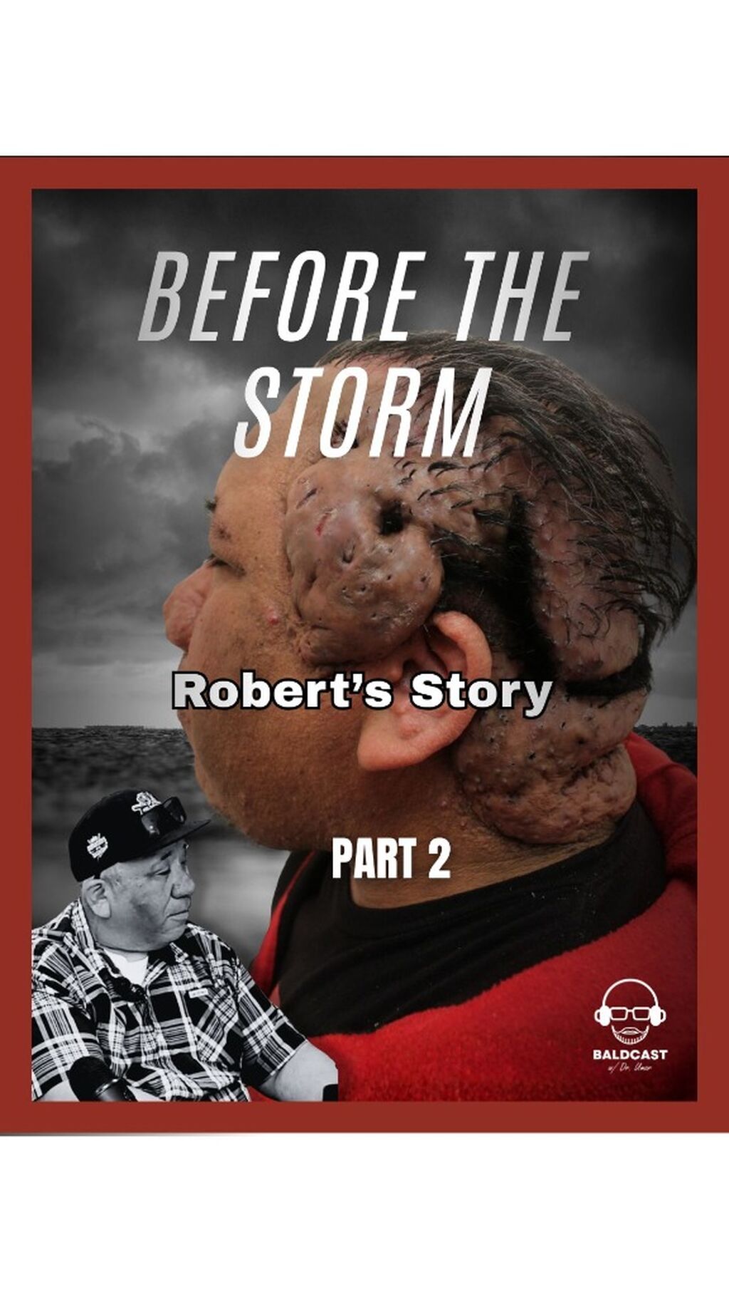 Before The Storm: Part 2