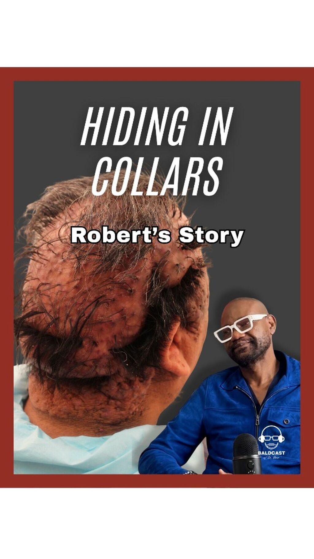Hiding In Collars