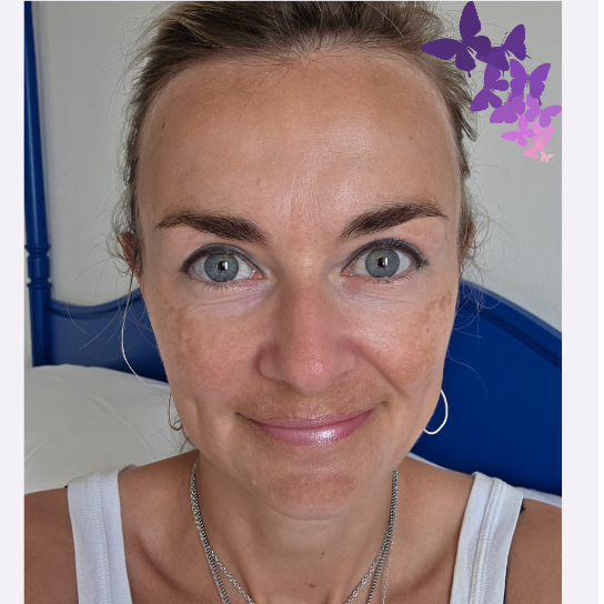 "My Lupus Journey" by Alexandra