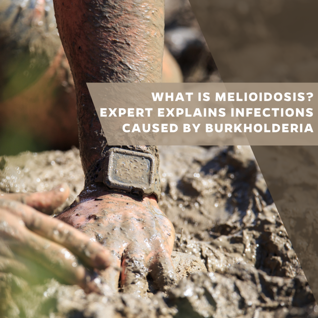 What is melioidosis?&nbsp;Expert&nbsp;explains&nbsp;infections caused by&nbsp;Burkholderia