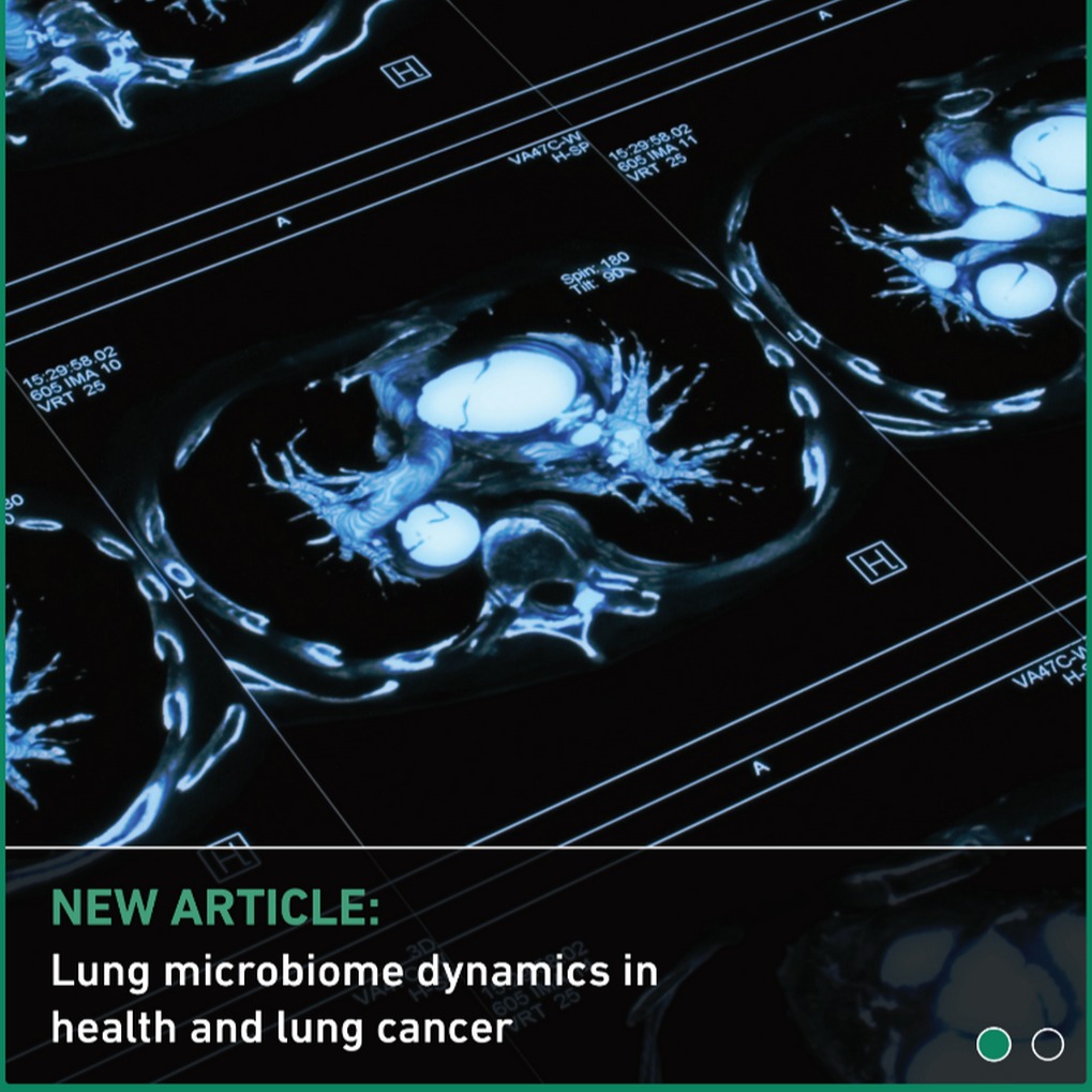 Lung microbiome dynamics in health and lung cancer