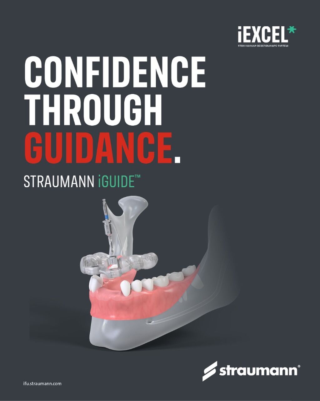 Straumann iGuide&trade;️