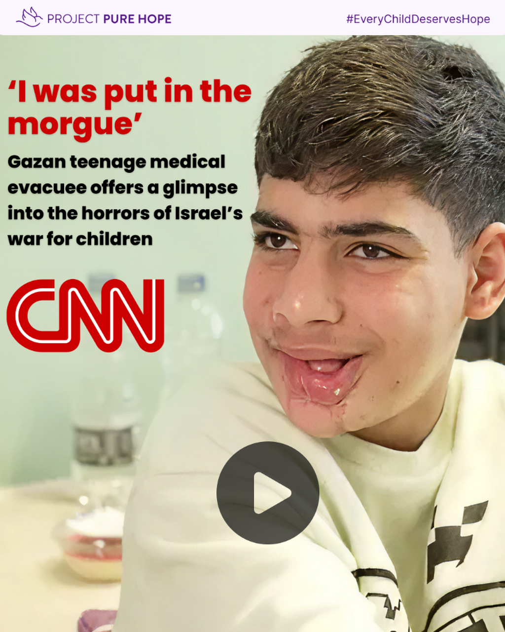 &lsquo;I was put in the morgue&rsquo;: Gaza teenage medical evacuee offers a glimpse into the horrors of Israel&rsquo;s war for children | CNN