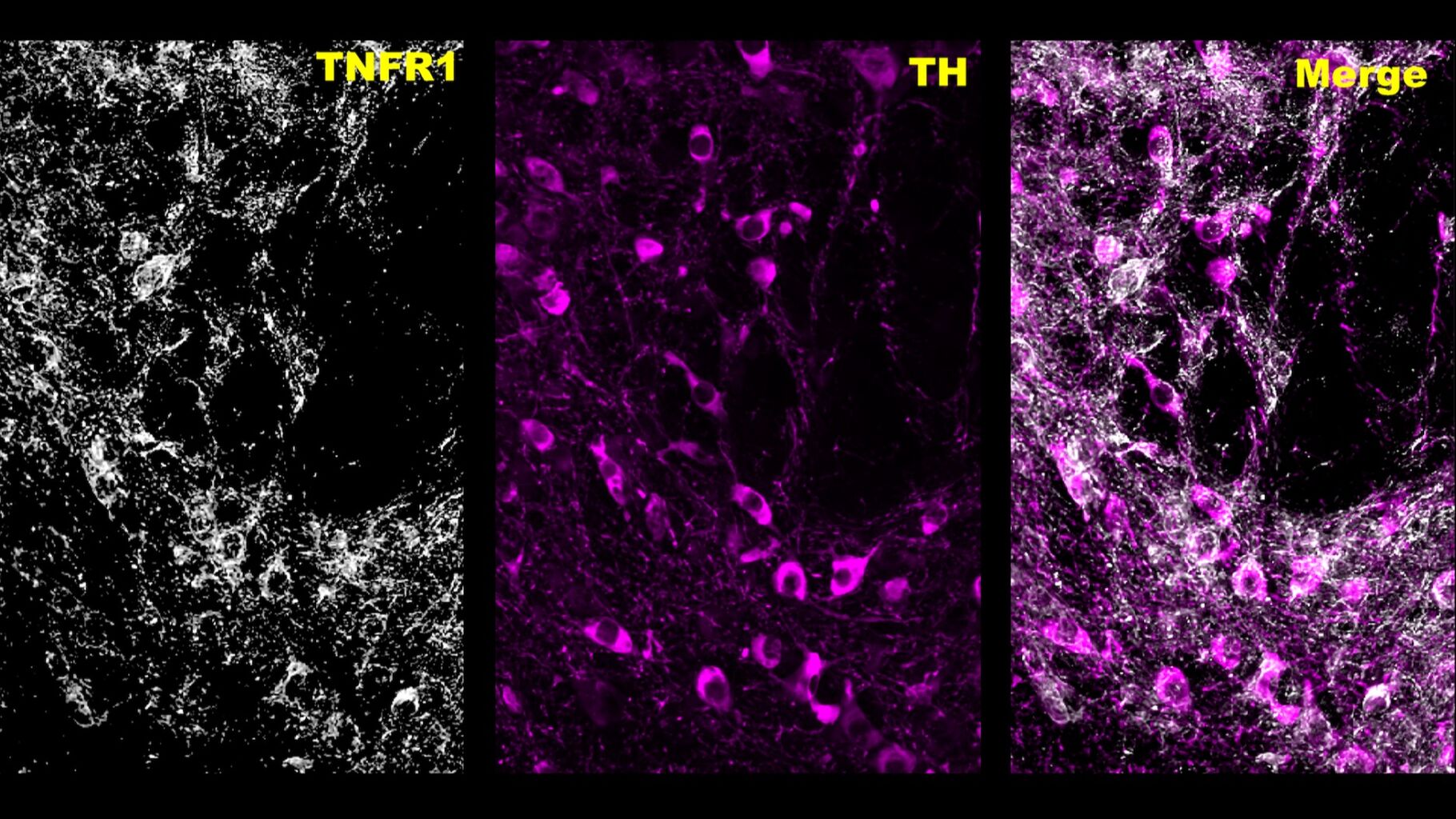 Unexpected finding could offer new treatment targets for meth addiction