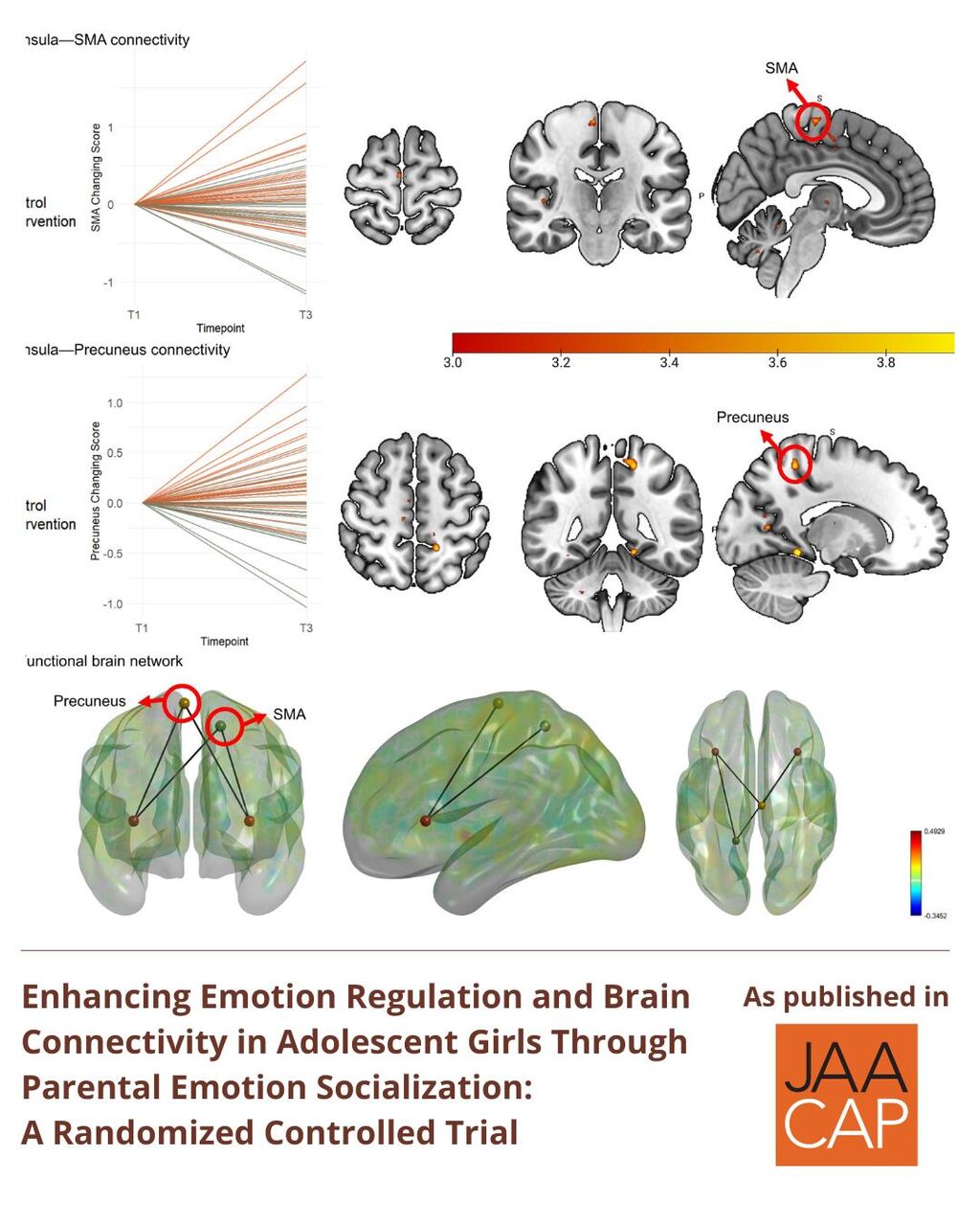 JAACAP AIP Enhancing Emotion Regulation and Brain Connectivity