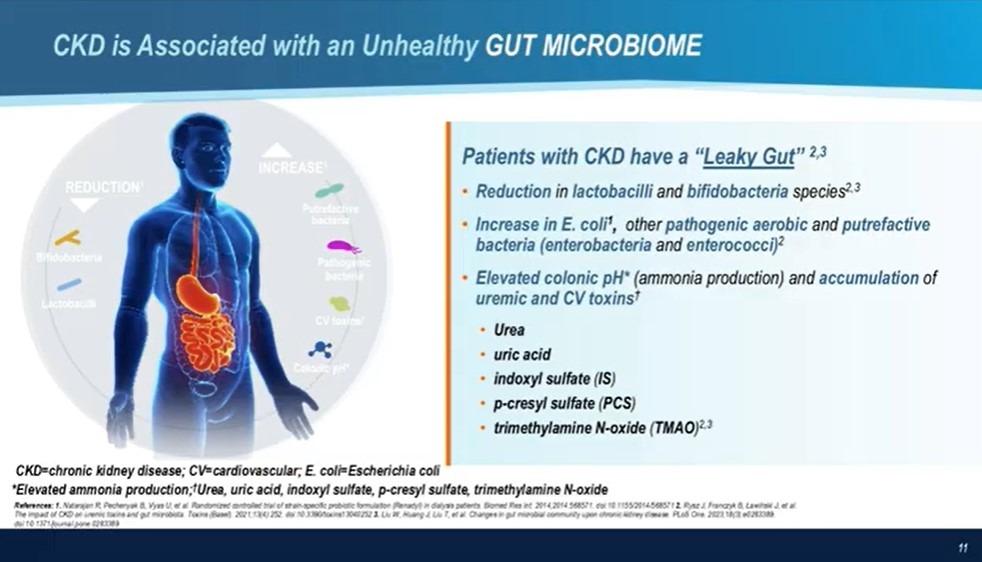 Chronic Kidney Disease: Does the Gut Matter?