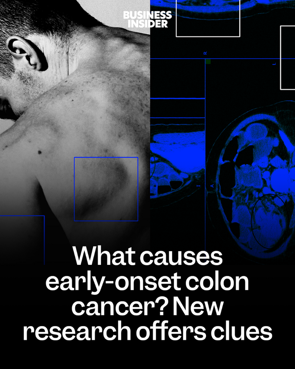 Young, fit &mdash; and hit with a deadly cancer