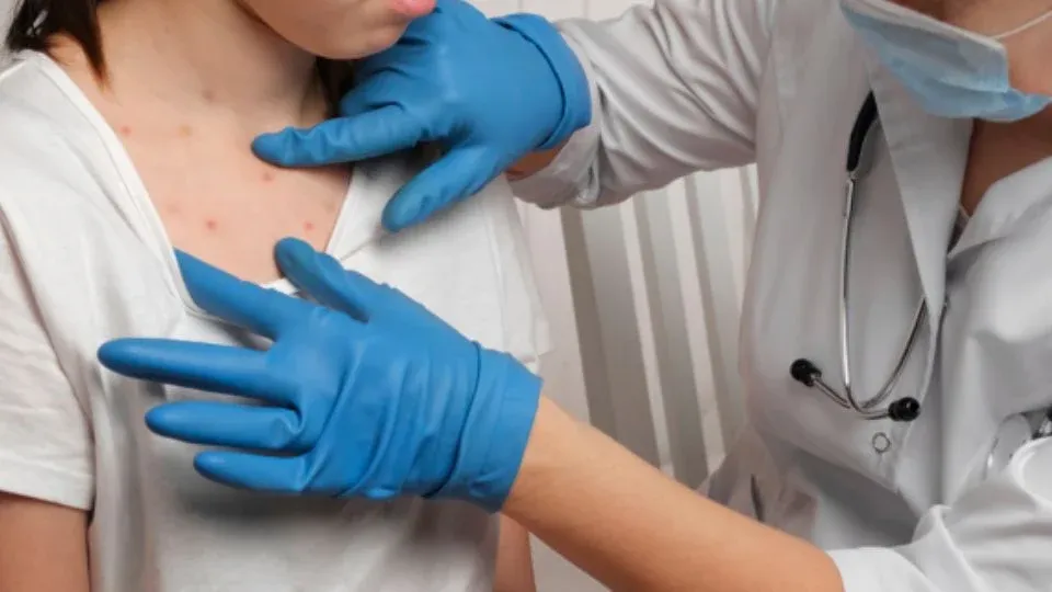 Sarampi&oacute;n es m&aacute;s contagioso que la COVID-19, advierten expertos de la UNAM