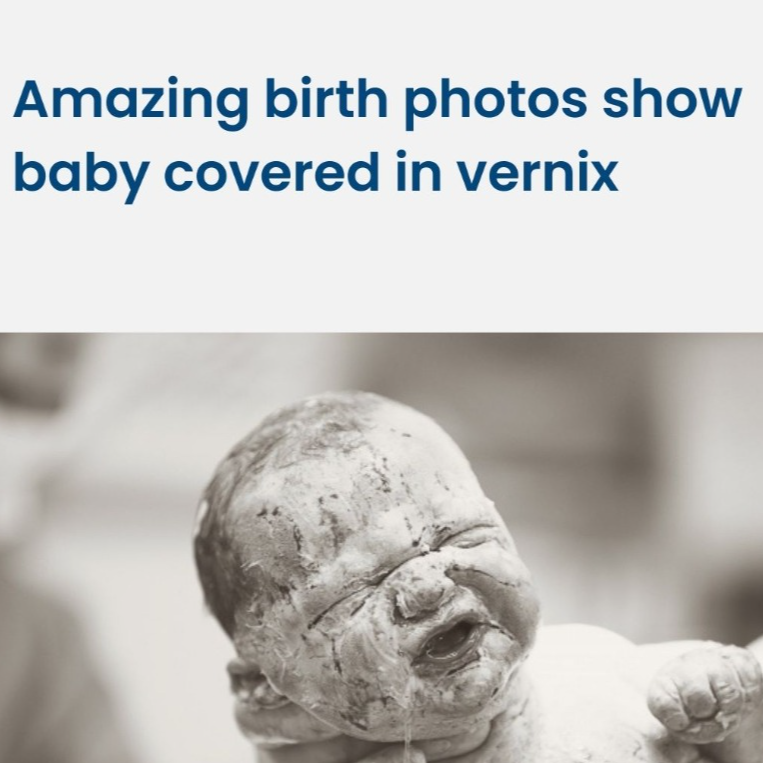 Amazing birth photos show baby covered in vernix