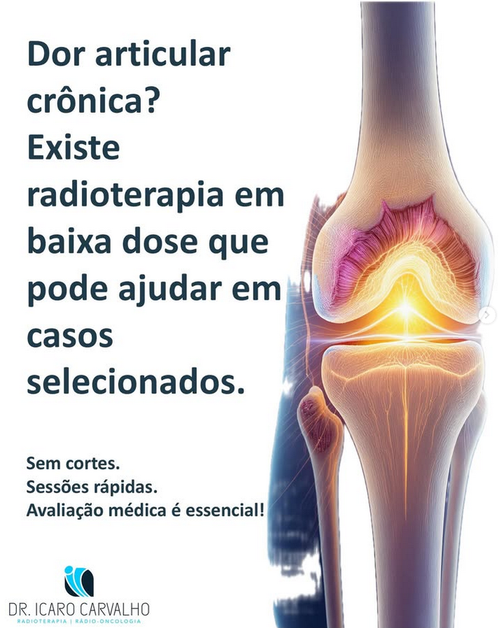 Radioterapia em Dores Articulares Cr&ocirc;nicas