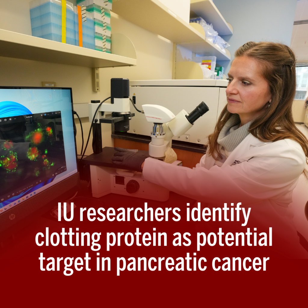 IU researchers identify clotting protein as potential target in pancreatic cancer