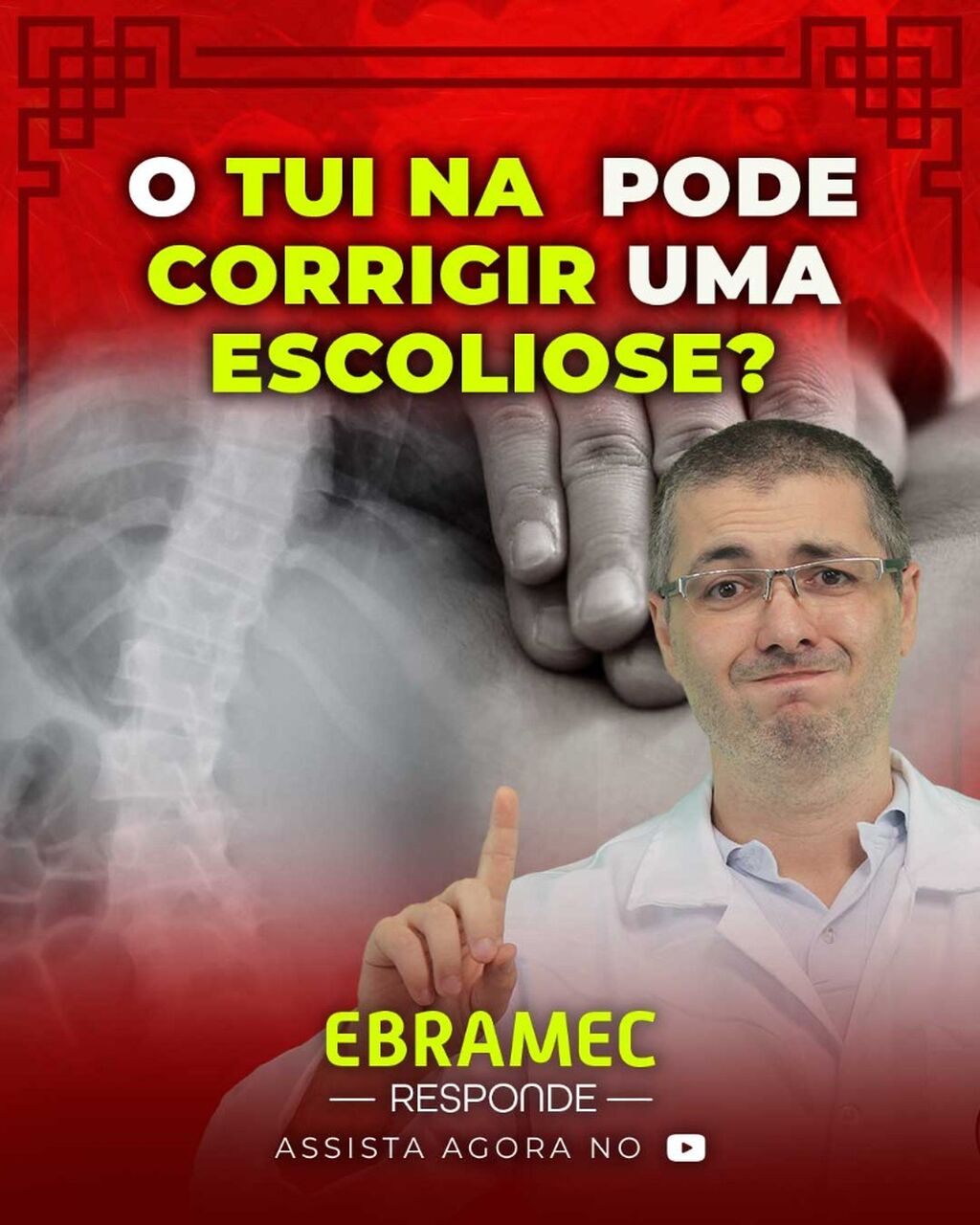 𝐎 𝐓𝐮𝐢𝐧𝐚 𝐩𝐨𝐝𝐞 𝐜𝐨𝐫𝐫𝐢𝐠𝐢𝐫 𝐮𝐦𝐚 𝐞𝐬𝐜𝐨𝐥𝐢𝐨𝐬𝐞?