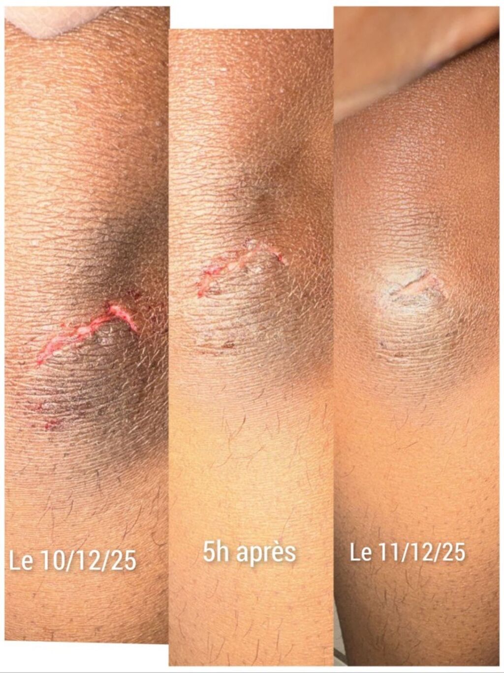 📸 +1000 Preuves Clients