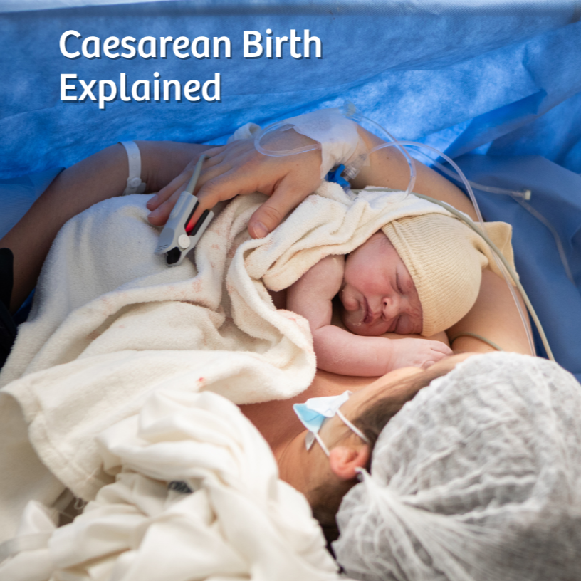 CAESAREAN BIRTH EXPLAINED