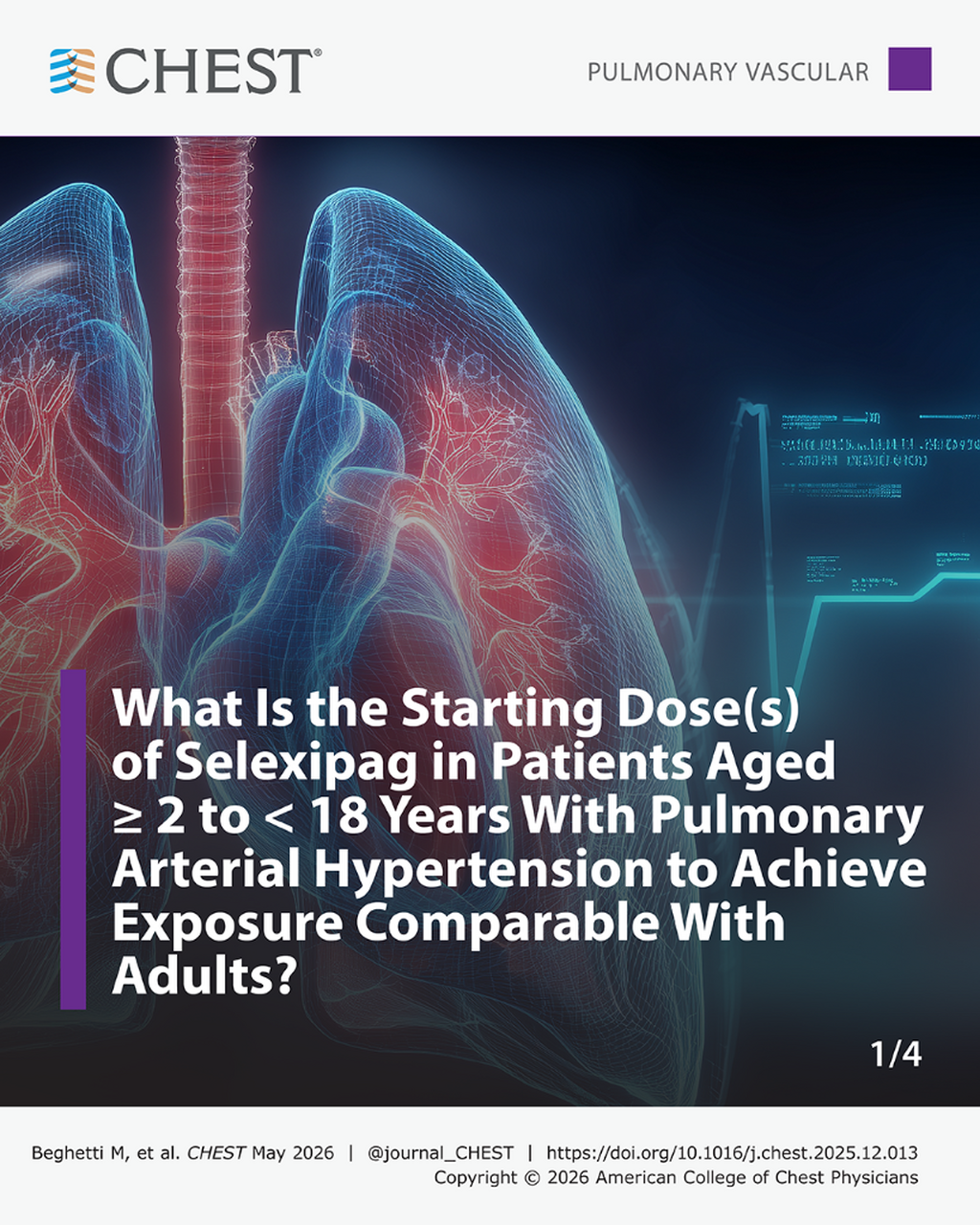 A Prospective, Multicenter, Open-Label, Single-Arm Phase 2 Study to Investigate the Pharmacokinetics, Safety, Tolerability, and Exploratory Efficacy of Selexipag in Children With Pulmonary Arterial Hypertension