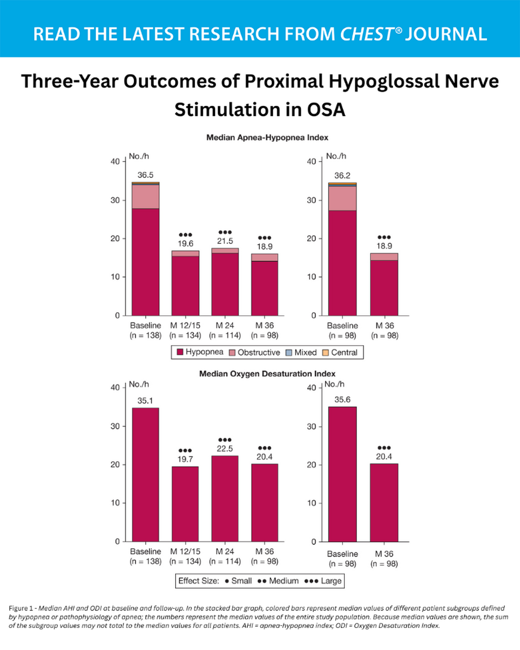 Three-Year Outcomes of Proximal Hypoglossal Nerve Stimulation in OSA