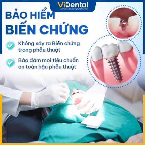 Bảo hiểm y tế trồng răng: Tất cả những điều cần biết