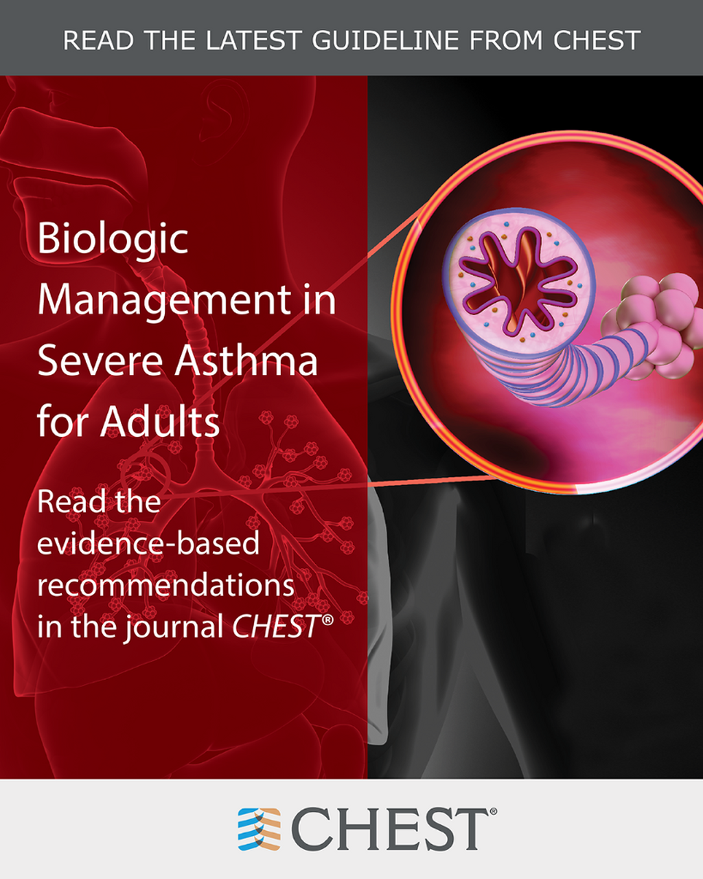 Biologic Management in Severe Asthma for Adults