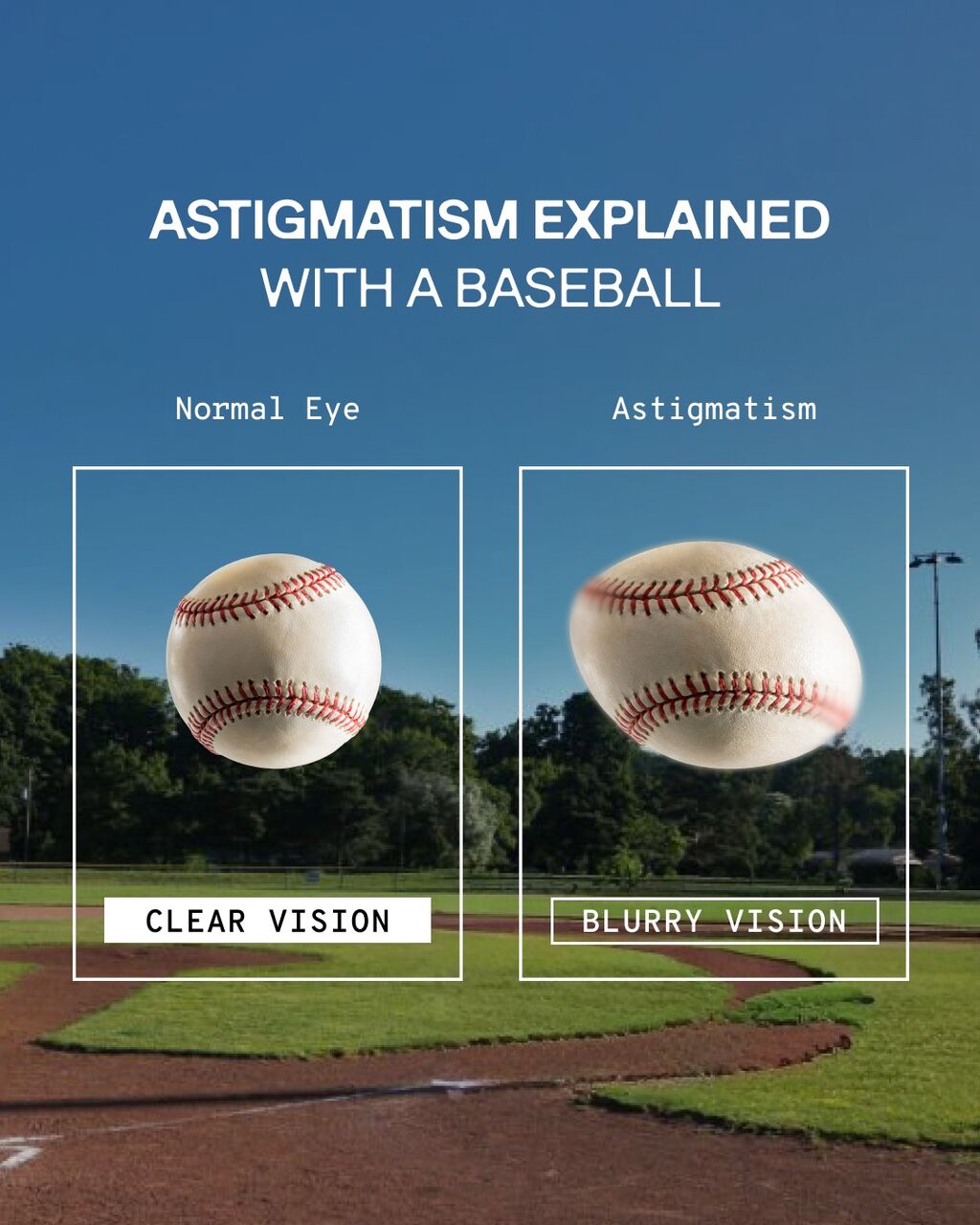 Astigmatism Explained