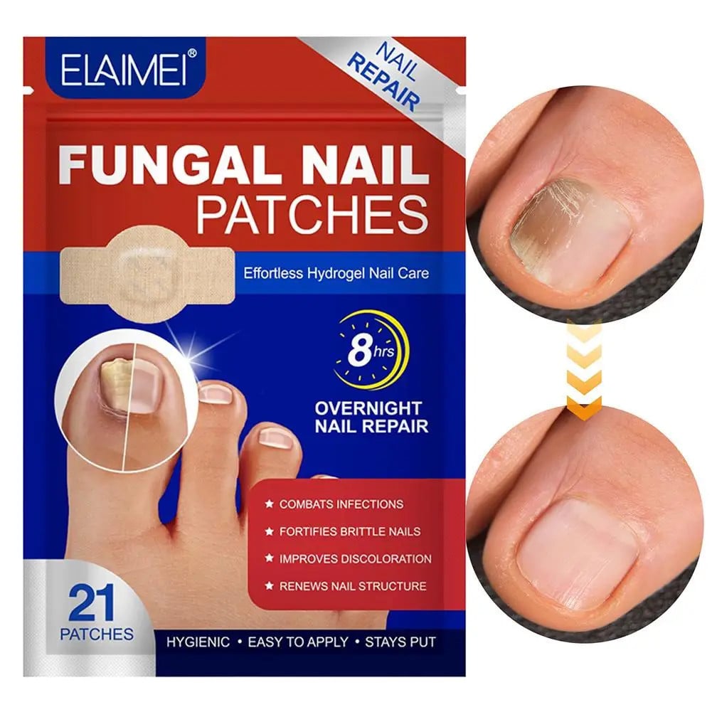 Fungal Nail Repair Patch Ingrown Correction Sticker 