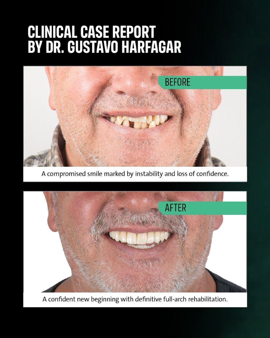 True purpose: The story and clinical case report of Dr. Gustavo Harfagar