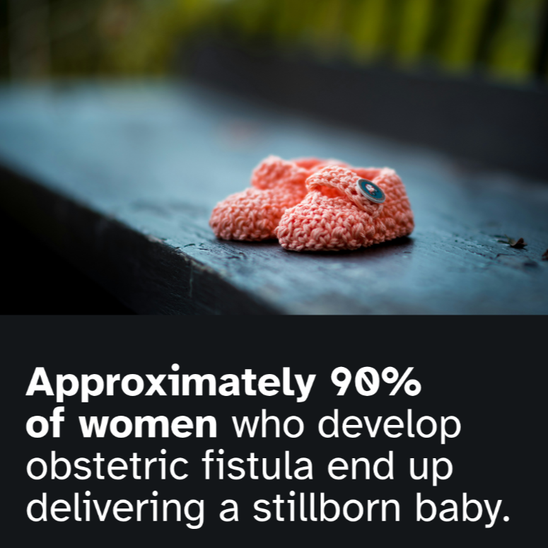 Obstetric fistula is a preventable