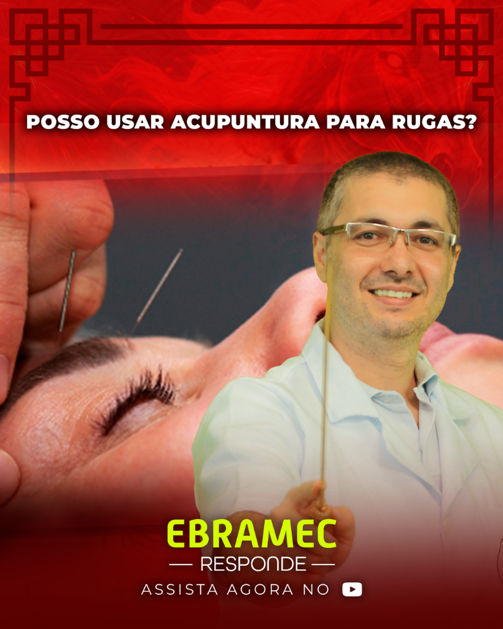 𝐏𝐨𝐬𝐬𝐨 𝐮𝐬𝐚𝐫 𝐀𝐜𝐮𝐩𝐮𝐧𝐭𝐮𝐫𝐚 𝐩𝐚𝐫𝐚 𝐫𝐮𝐠𝐚𝐬?