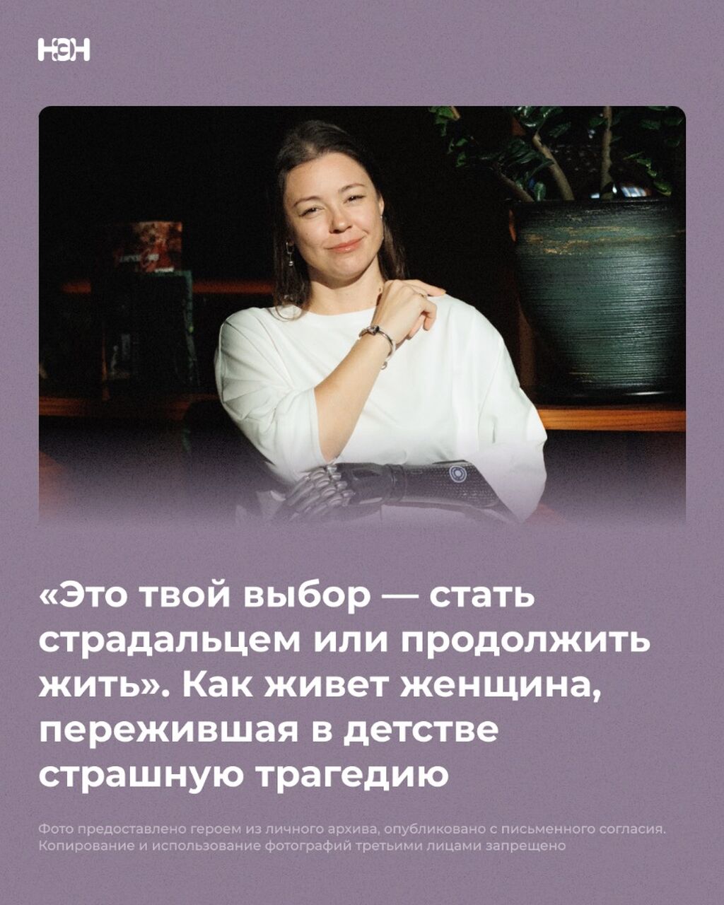 Как живет женщина, в детстве потерявшая руку