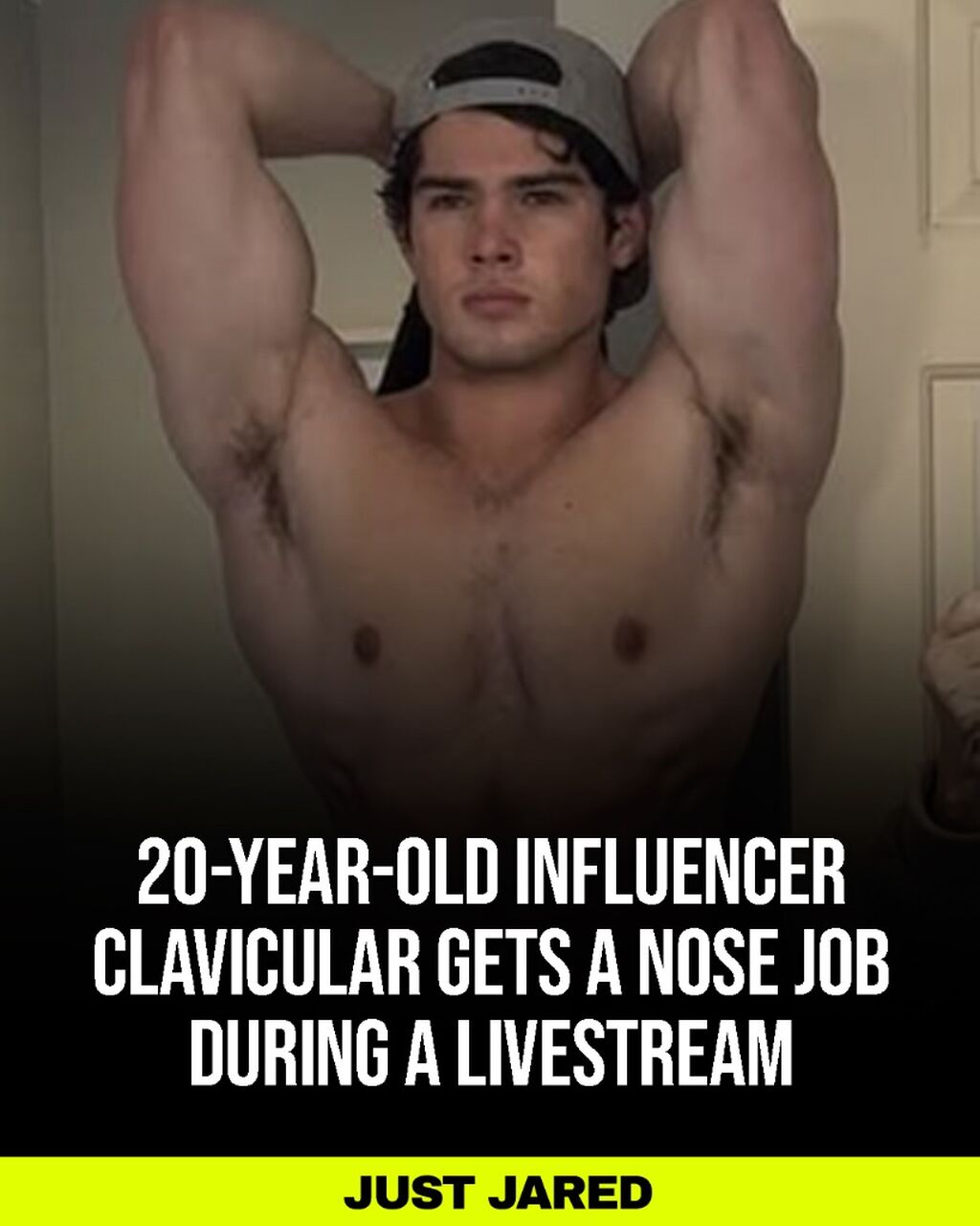 20-Year-Old Influencer Clavicular Livestreams Nose Job Surgery for Thousands of Viewers