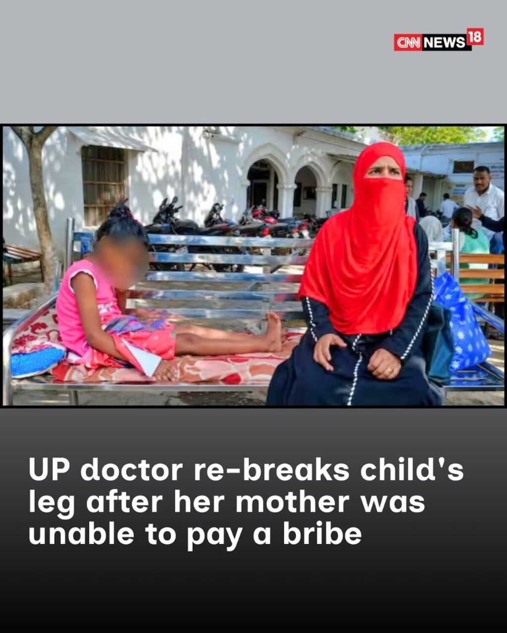UP Doctor Re-Breaks Child's Leg After Mother Could Not Pay Bribe, CMO Had Directed Free Treatment