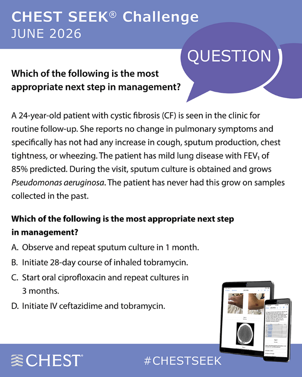 CHEST SEEK Challenge Question June 2026 (June 5)