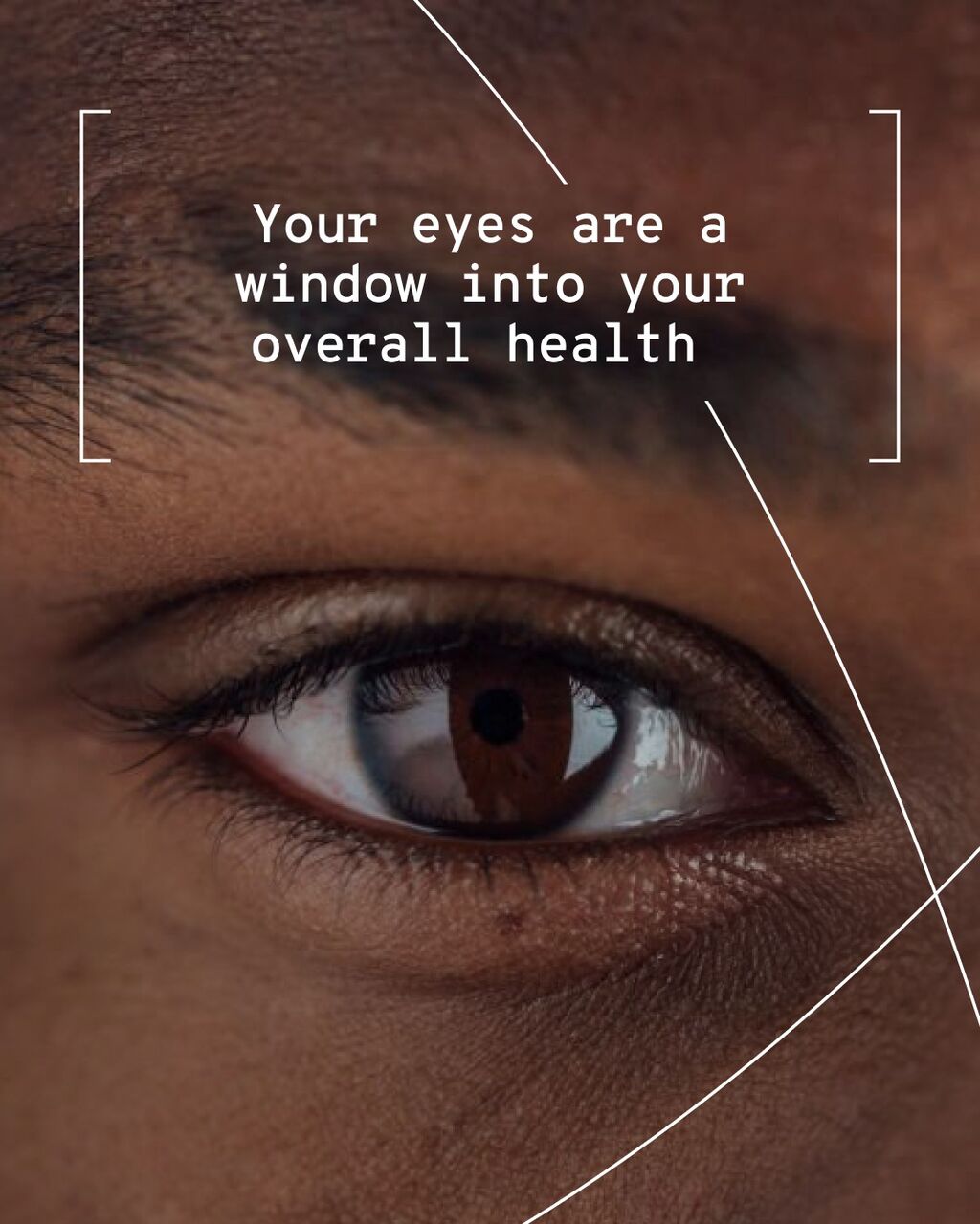 Eye to Body Connection