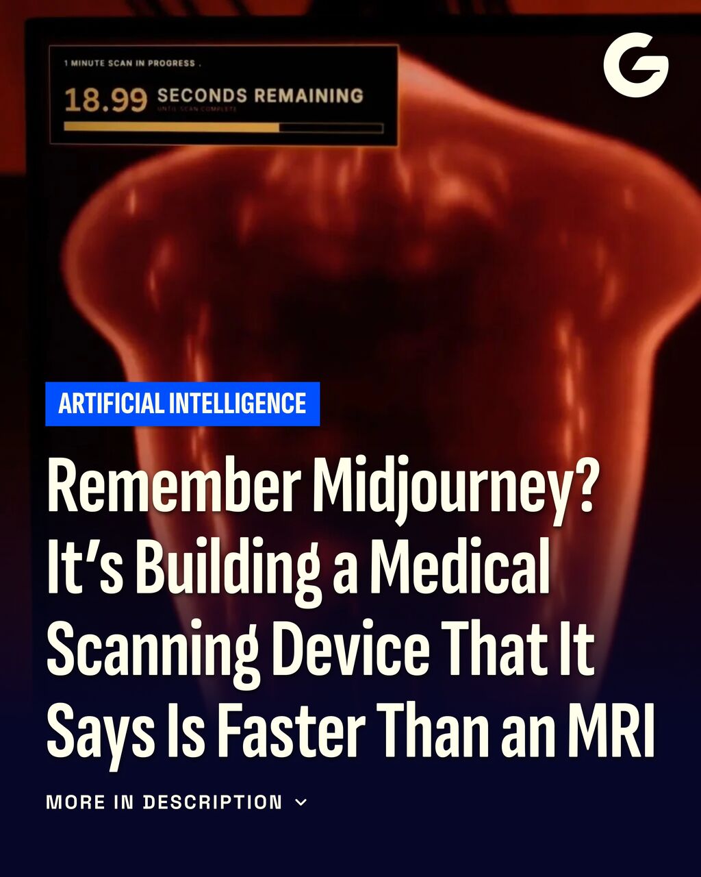 Remember Midjourney? It&rsquo;s Building a Medical Scanning Device That It Says Is Faster Than an MRI