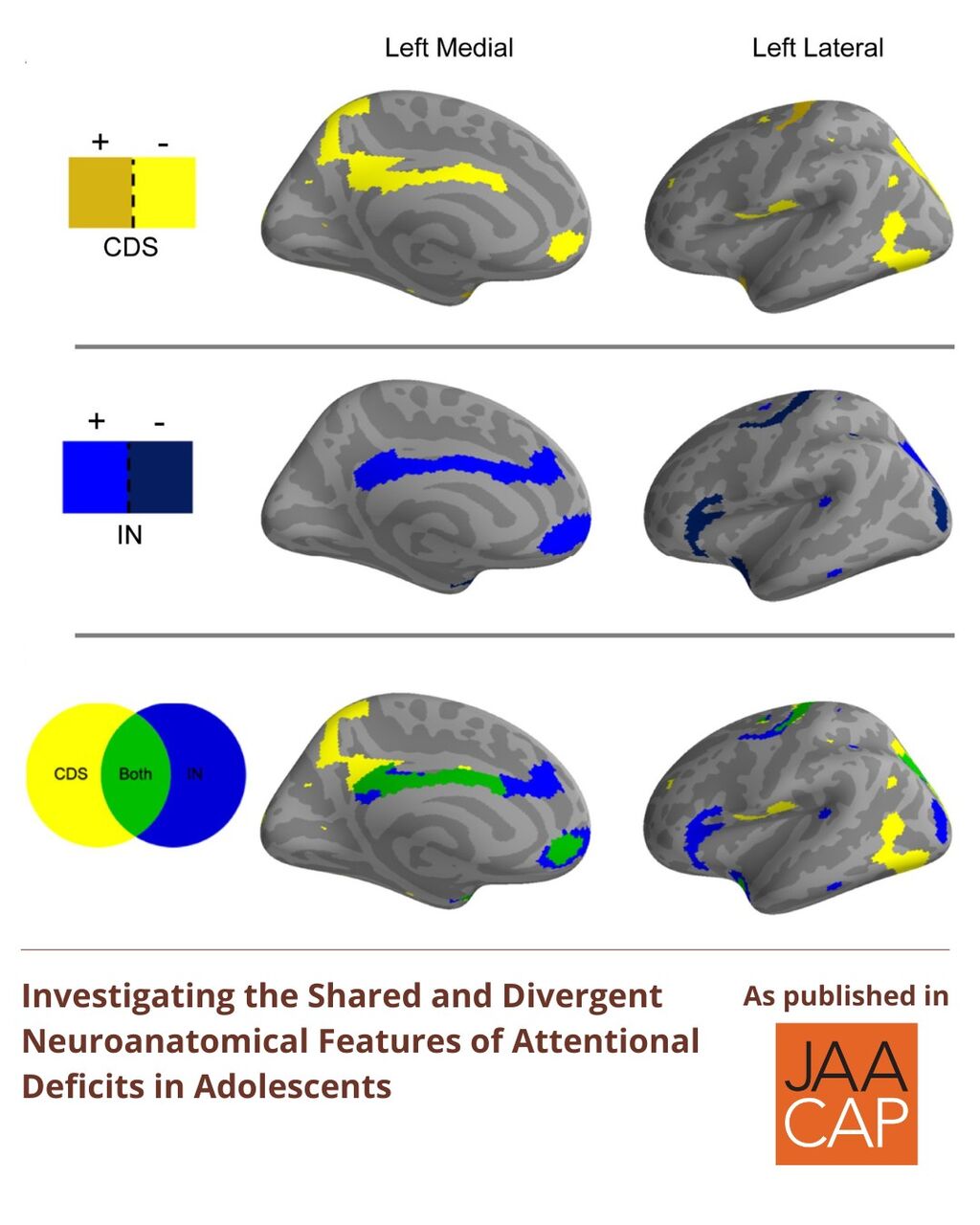 JAACAP 0626 Investigating the Shared and Divergent Neuroanatomical Features of Attentional Deficits in Adolescents