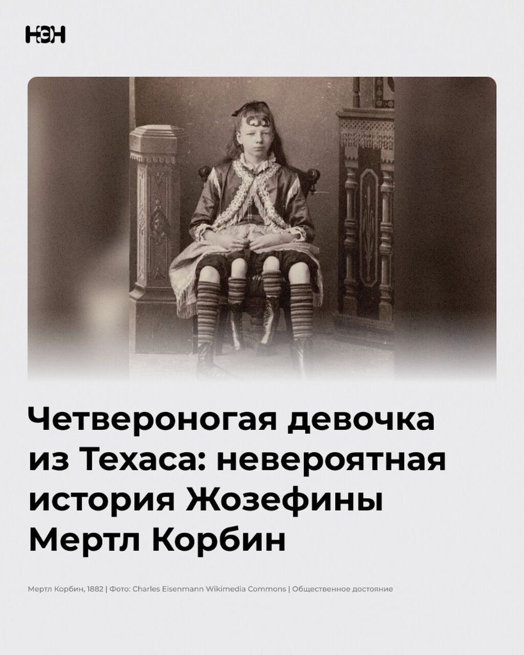 Четвероногая девочка из Техаса